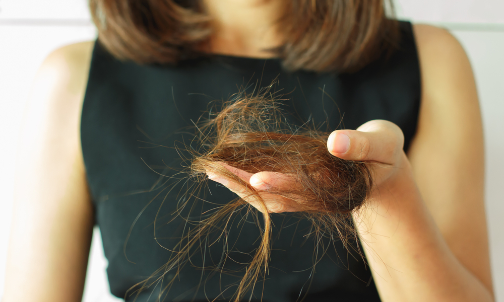 queda de cabelo em mulheres